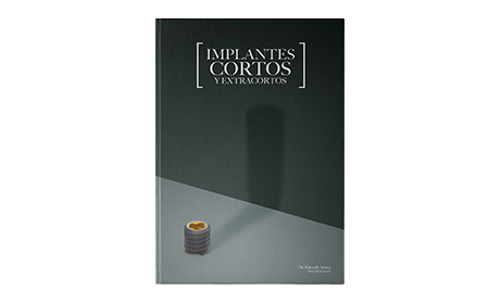 Implantes cortos y extracortos por Eduardo Anitua
